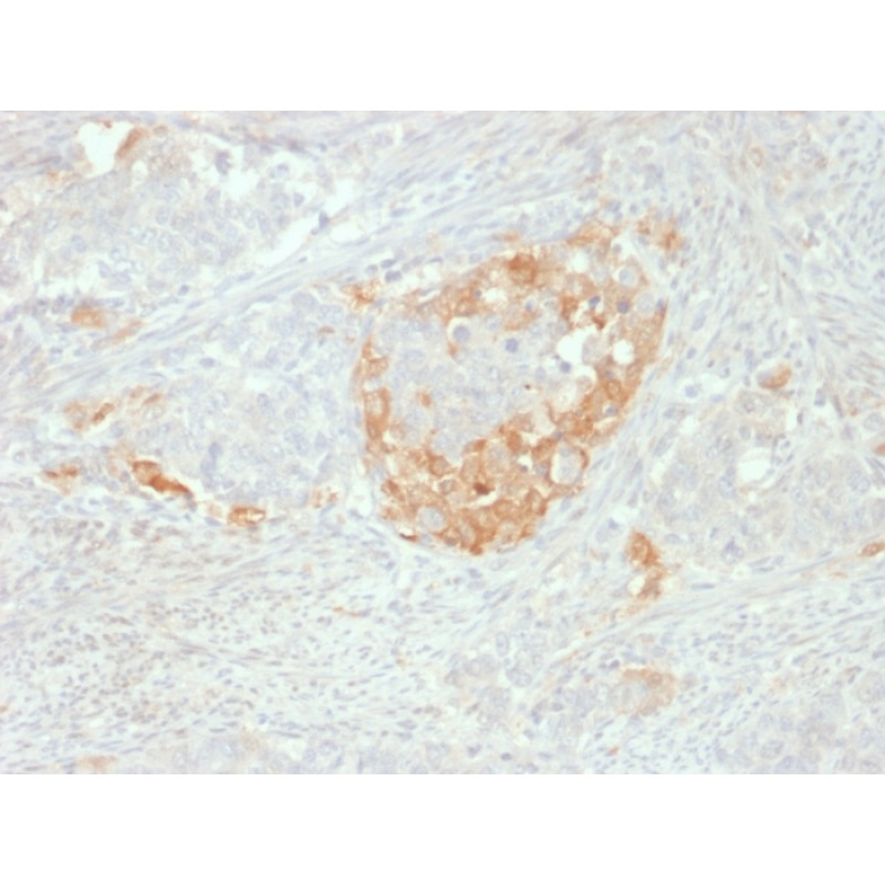 NSE gamma (Neuron Specific Enolase, gamma) (Neuroendocrine Marker)(NSE-P2), CF568 conjugate, 0.1mg/mL