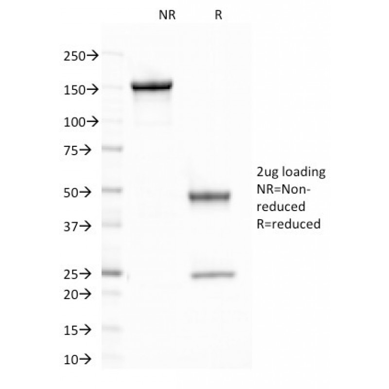 CELA3B / ELA3B (Pancreatic Function Marker)(CELA3B/1758), CF568 conjugate, 0.1mg/mL