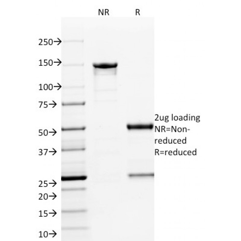ETS1 (Marker of Tumor Metastasis)(ETS1/1801), CF568 conjugate, 0.1mg/mL
