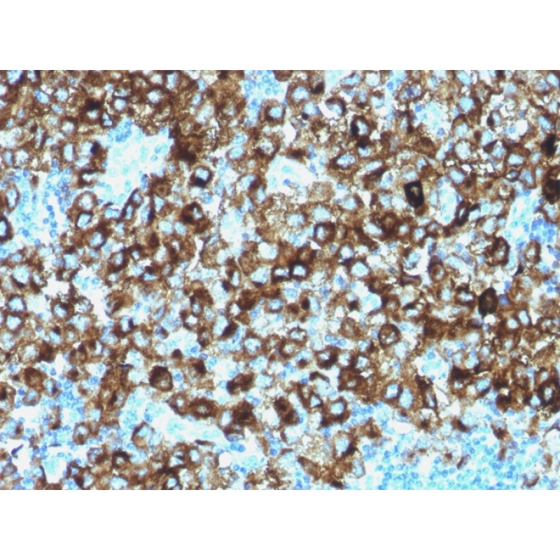 gp100 / Melanosome / PMEL17 / SILV (Melanoma Marker)(N/A), CF568 conjugate, 0.1mg/mL