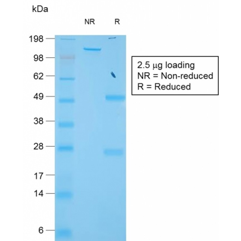TIMP1 (Colorectal and Lymph Node Metastasis Marker)(TIMP1/1944R), CF568 conjugate, 0.1mg/mL