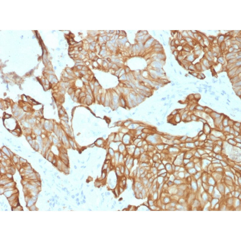 Cytokeratin 19 (Pancreatic Stem Cell Marker) (rKRT19/800), CF568 conjugate, 0.1mg/mL