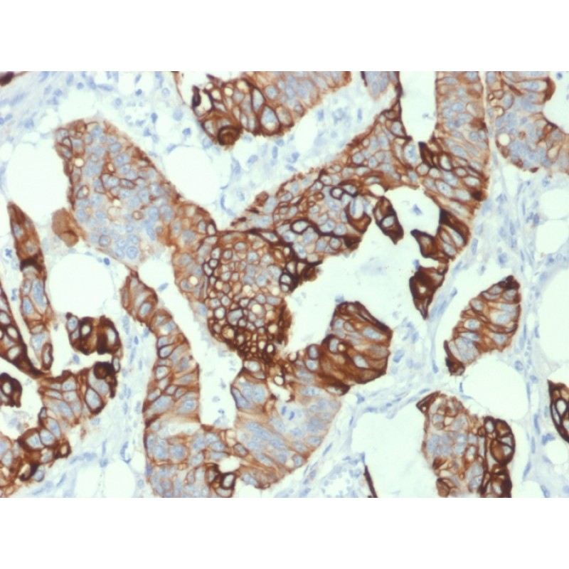 Cytokeratin 20 (KRT20) (Colorectal Epithelial Marker)(KRT20/1993), CF568 conjugate, 0.1mg/mL