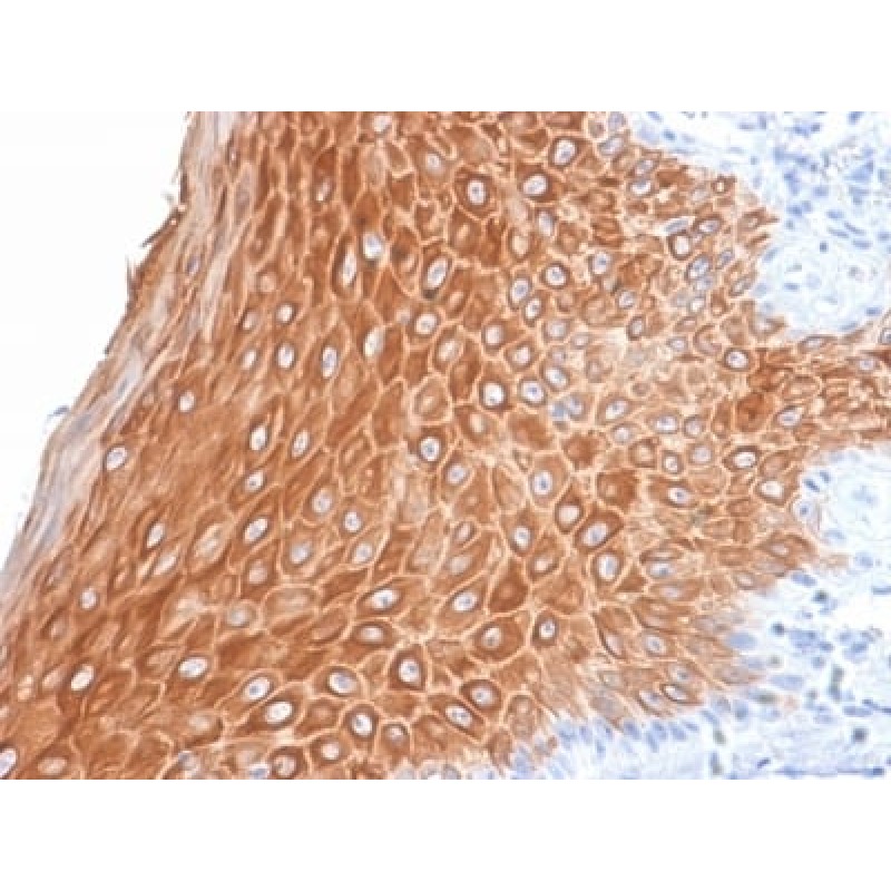 Cytokeratin 16 (KRT16) (Suprabasal Keratinocyte Marker) (KRT16/2043R), CF568 conjugate, 0.1mg/mL