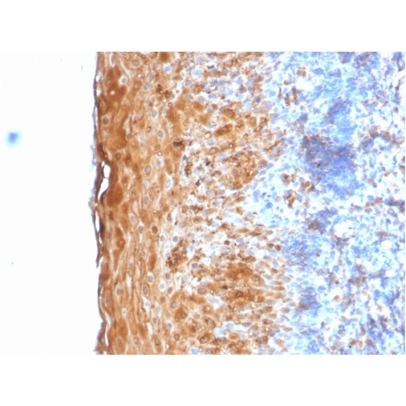 Involucrin (Squamous Cell Terminal Differentiation Marker)(IVRN/2113R), CF568 conjugate, 0.1mg/mL