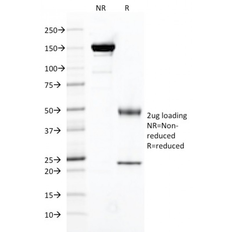 FOLH1 / PSMA (Prostate Epithelial Marker)(FOLH1/2121), CF568 conjugate, 0.1mg/mL