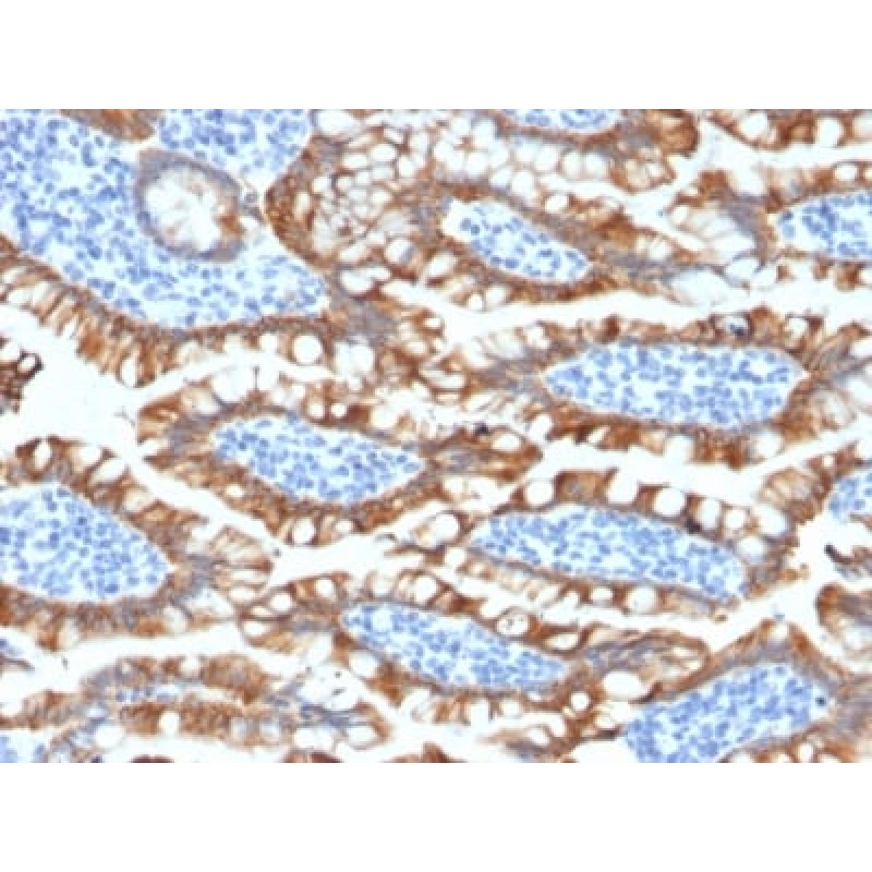 Cytokeratin 8 (KRT8) (KRT8/2174R), CF568 conjugate, 0.1mg/mL