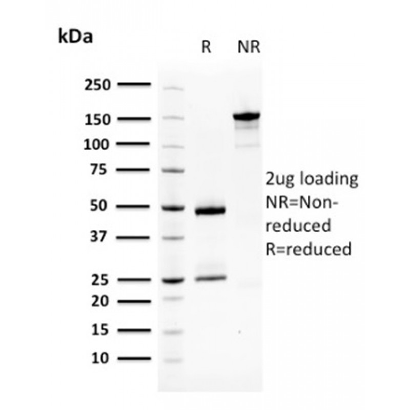 Squamous Cell Carcinoma Antigen 1(CPTC-SERPINB3-2), CF568 conjugate, 0.1mg/mL