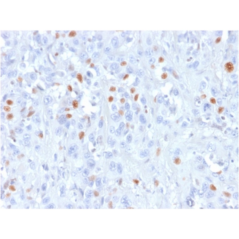 p21WAF1 (Tumor Suppressor Protein)(rCIP1/823), CF568 conjugate, 0.1mg/mL