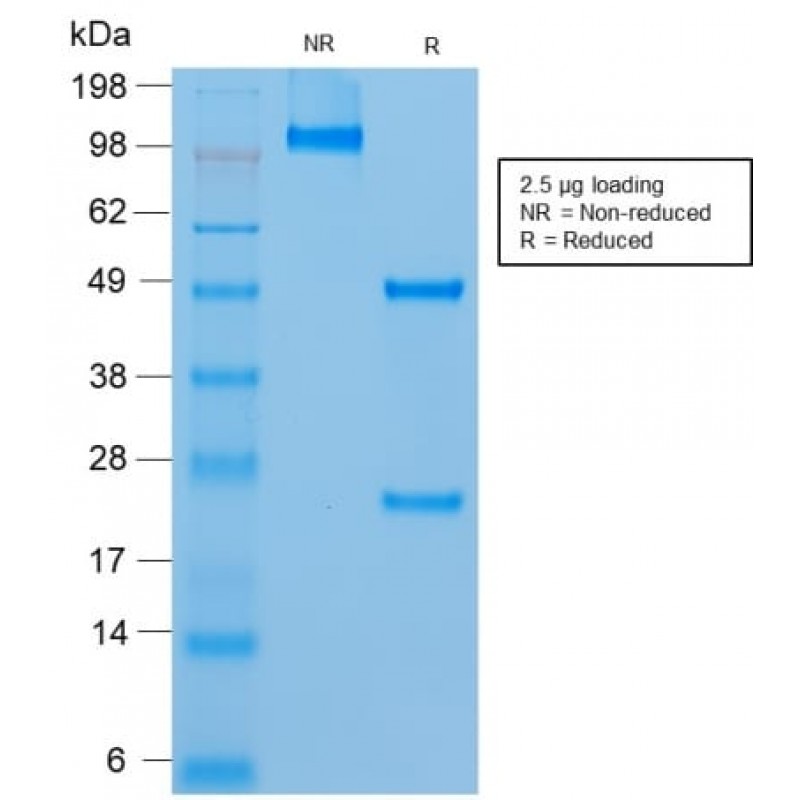 MUC18 / CD146 / MCAM (Melanoma Cell Adhesion Molecule) (rMUC18/1130), CF568 conjugate, 0.1mg/mL