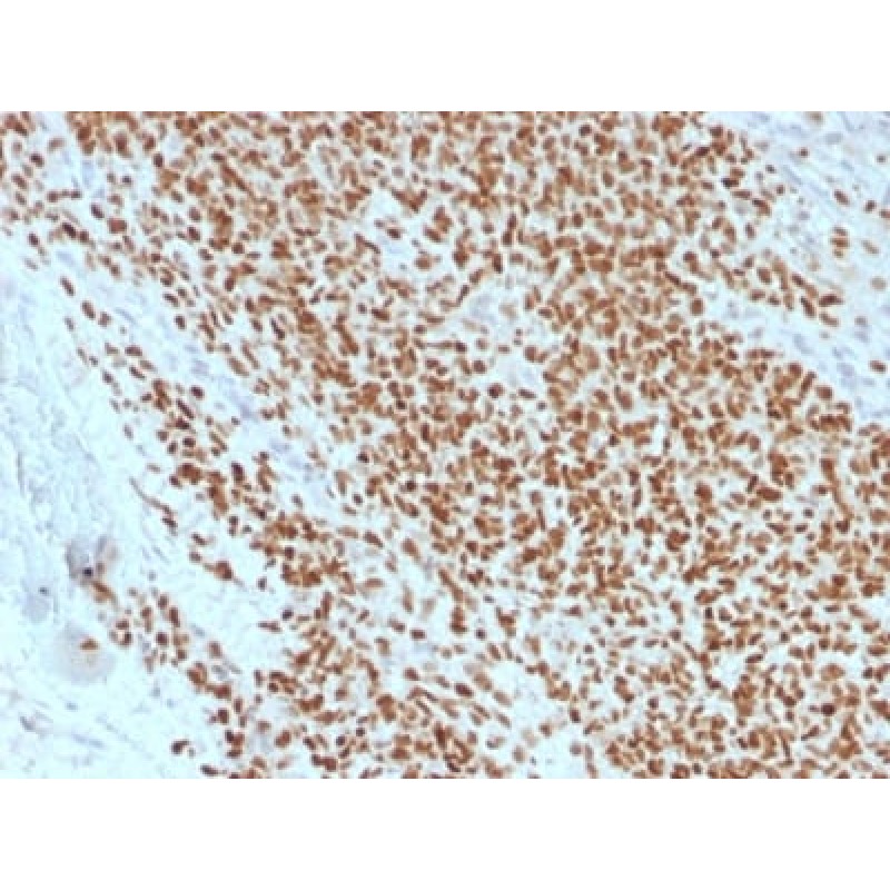 NKX2.2 (Neuroendocrine & Ewing s Sarcoma Marker) (rNX2/1523), CF568 conjugate, 0.1mg/mL