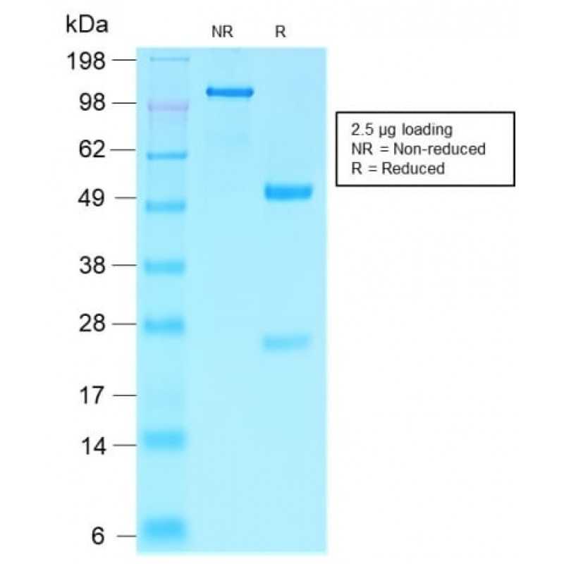 Villin (GI-Mucosal & Urogenital Brush Border Marker) (VIL1/2310R), CF568 conjugate, 0.1mg/mL