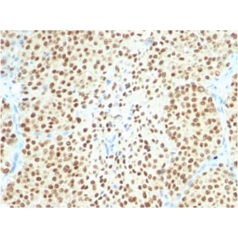 SOX10 (Melanoma Marker) (SOX10/2311R), CF568 conjugate, 0.1mg/mL
