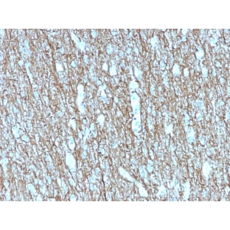 Neurofilament (NF-H) (Neuronal Marker) (rNF421), CF568 conjugate, 0.1mg/mL