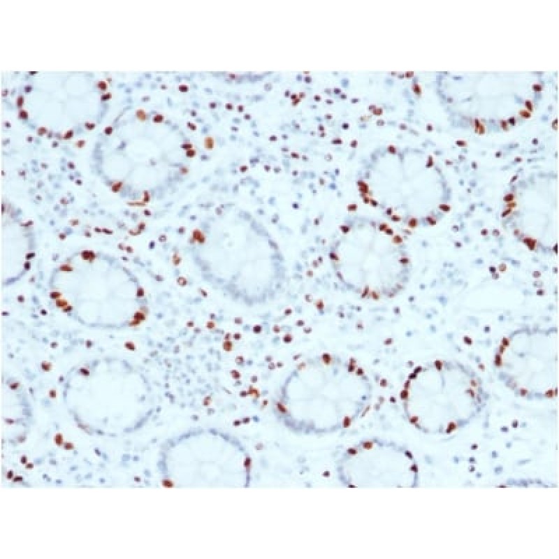 SOX4 (Master Regulator of Epithelial-Mesenchymal Transition) (SOX4/2540), CF568 conjugate, 0.1mg/mL