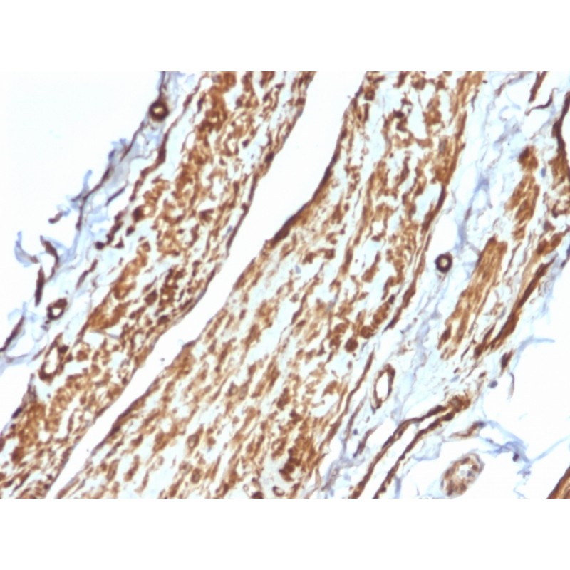 Vinculin (Marker of Age-related Macular Degeneration)(VCL/2575), CF568 conjugate, 0.1mg/mL