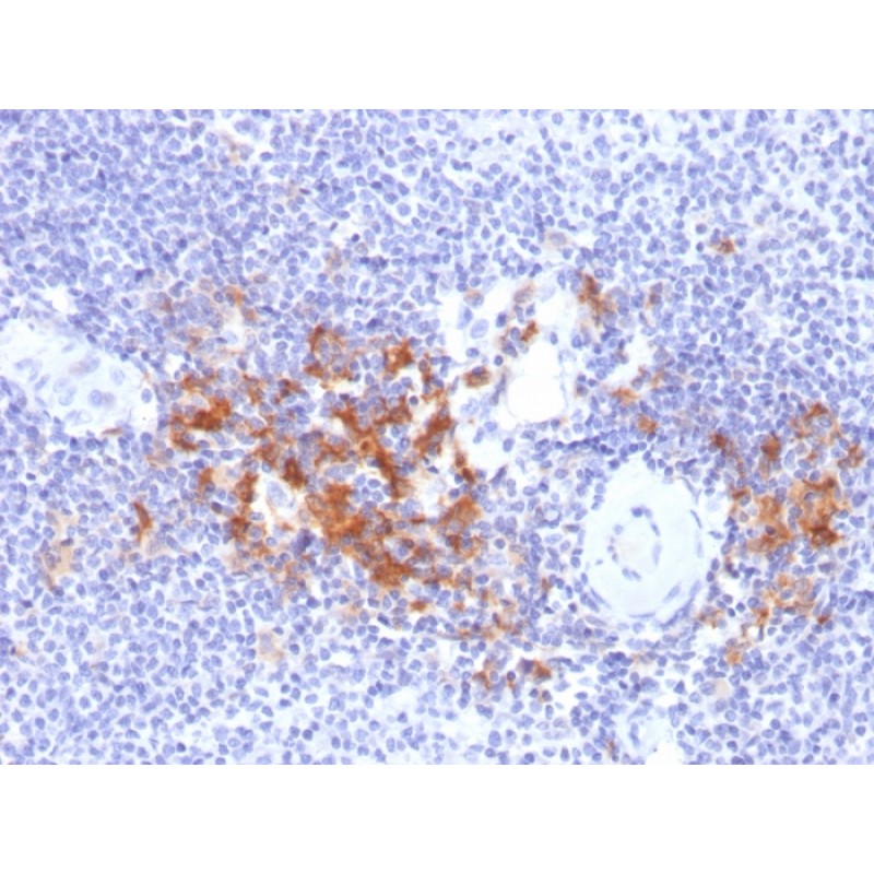 TRAF1 (TNFR-Associated Factor 1) (Lymphomatoid Papulosis Marker)(TRAF1/2770), CF568 conjugate, 0.1mg/mL