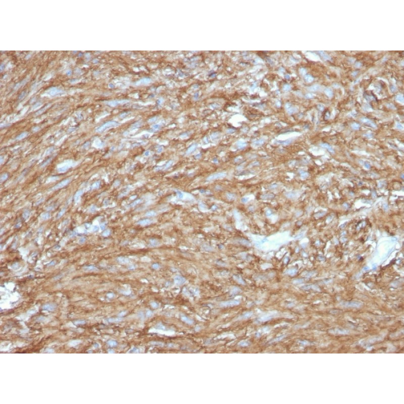 DOG-1 / TMEM16A (Gastrointestinal Stromal Tumor Marker)(DG1/2831R), CF568 conjugate, 0.1mg/mL