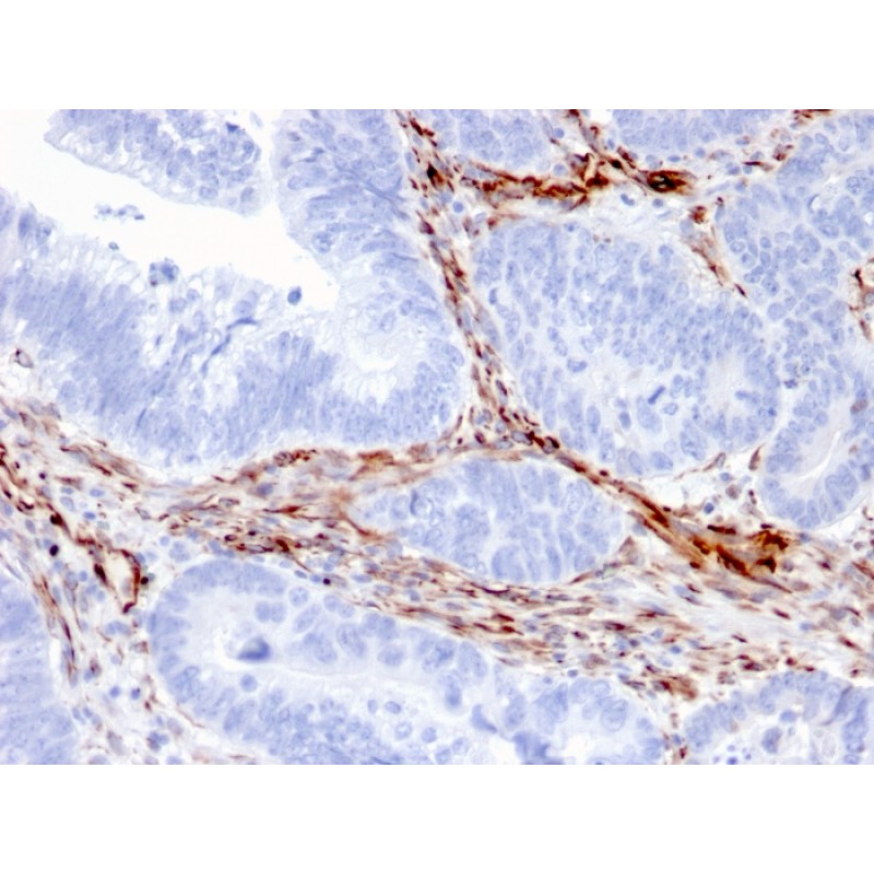 Nestin (Cancer Stem Cell Marker)(NES/2911), CF568 conjugate, 0.1mg/mL