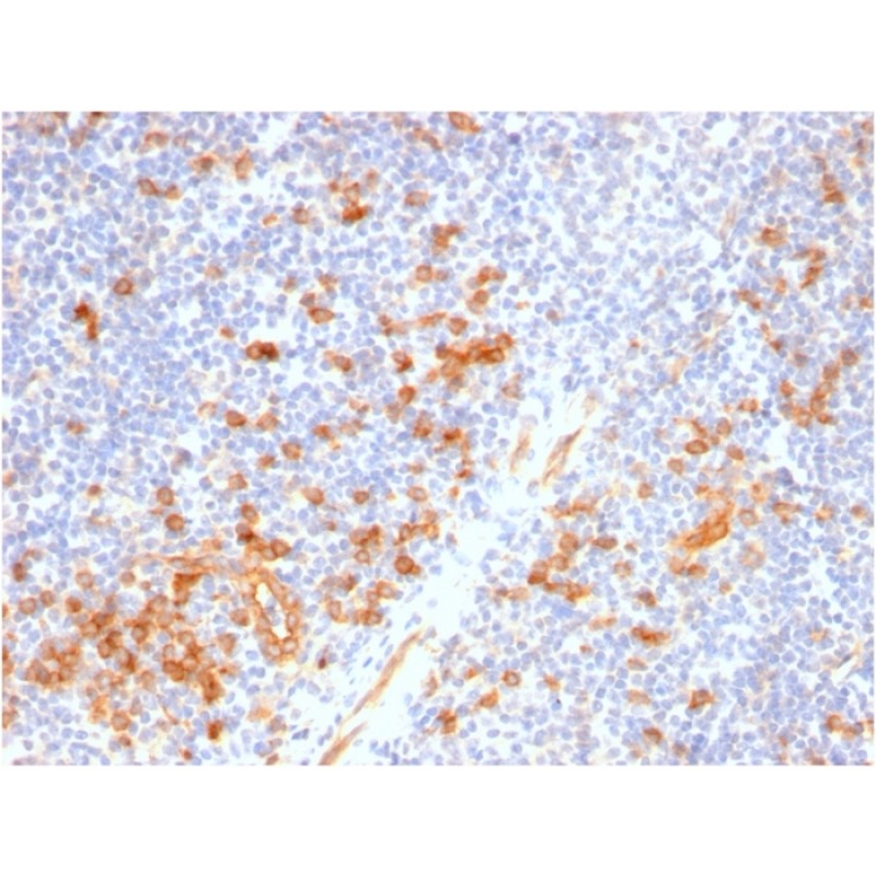 IL3RA / CD123 (Acute Myeloid Leukemia Marker)(IL3RA/2947R), CF568 conjugate, 0.1mg/mL