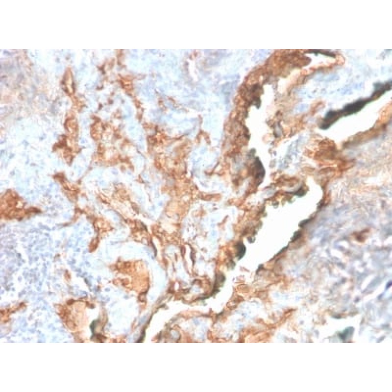 Tenascin C (Stromal Marker For Epithelial Malignancy) (TNC/2981R), CF568 conjugate, 0.1mg/mL