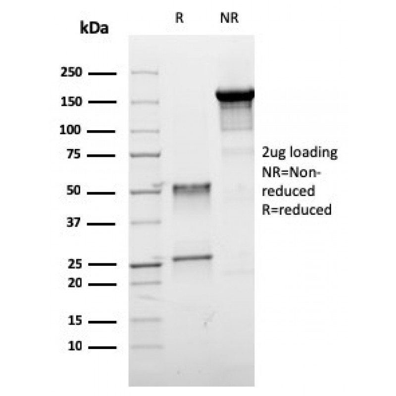 ER-beta-1 (Estrogen Receptor beta-1)(ESR2/3005), CF568 conjugate, 0.1mg/mL