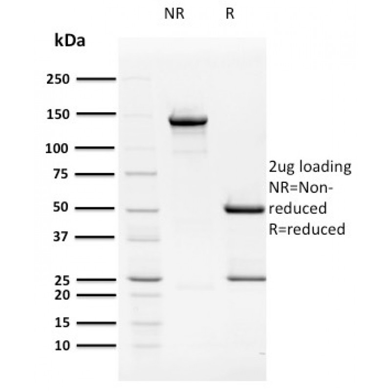HPV16 E2 (Human Papilloma Virus 16)(TVG 261), CF568 conjugate, 0.1mg/mL