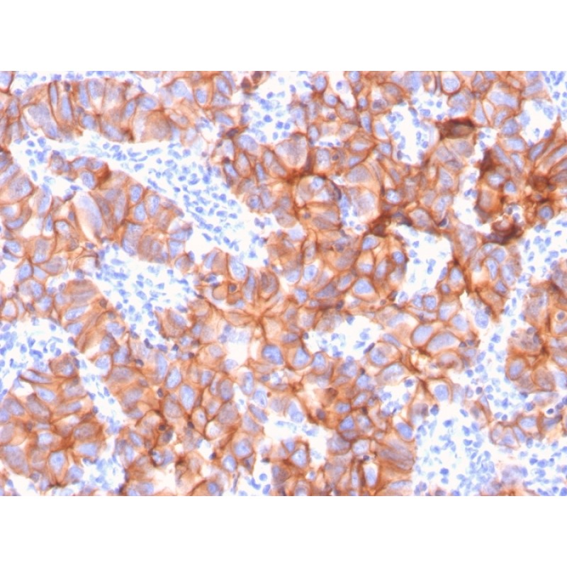 HER-2 / c-erbB-2 / neu / CD340(ERBB2/3079), CF568 conjugate, 0.1mg/mL