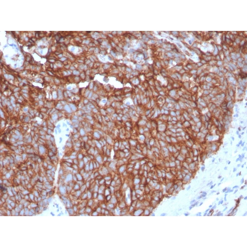 GLUT-1 (Tumor Progression and Mesothelioma Marker)(GLUT1/3132R), CF568 conjugate, 0.1mg/mL