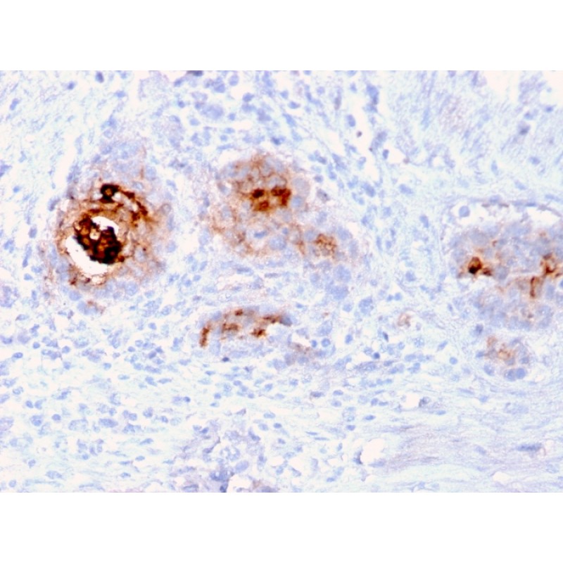 TAG-72 / CA72.4 (Tumor-Associated Glycoprotein)(rB72.3), CF568 conjugate, 0.1mg/mL