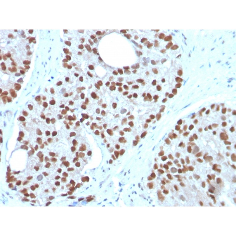 NKX3.1 (Metastatic Prostate Adenocarcinoma Marker)(NKX3.1/3350), CF568 conjugate, 0.1mg/mL