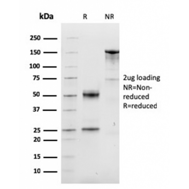 Cyclin D1 (G1-Cyclin & Mantle Cell Lymphoma Marker)(CCND1/3548), CF568 conjugate, 0.1mg/mL