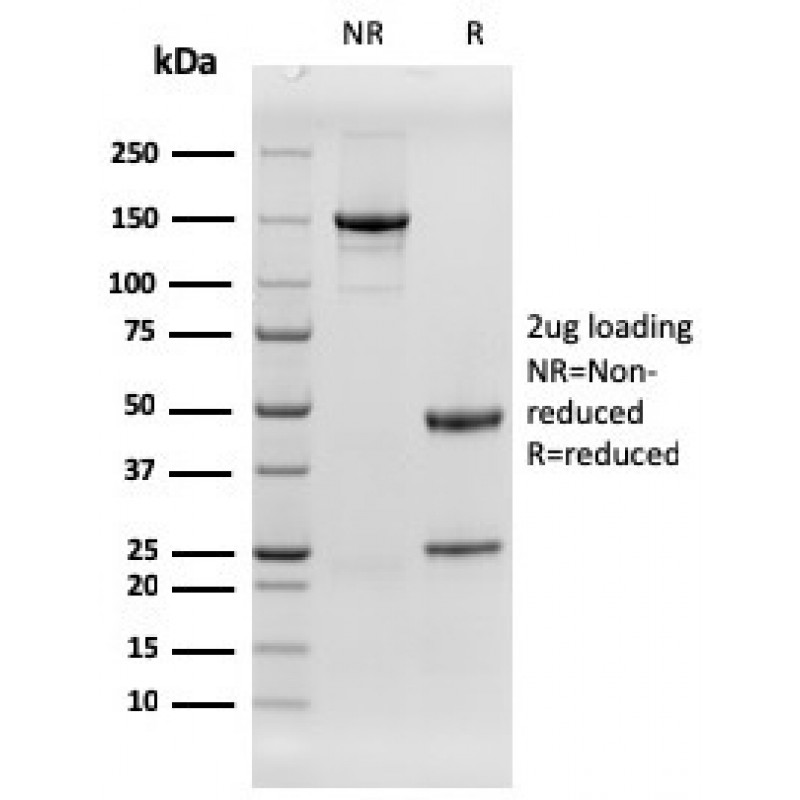 EGFR (Epidermal Growth Factor Receptor)(rGFR/1667), CF568 conjugate, 0.1mg/mL