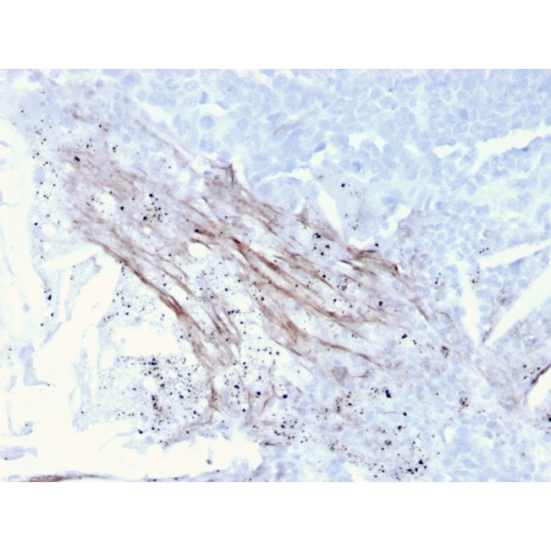 Tenascin C (Stromal Marker for Epithelial Malignancy)(TNC/3635), CF568 conjugate, 0.1mg/mL