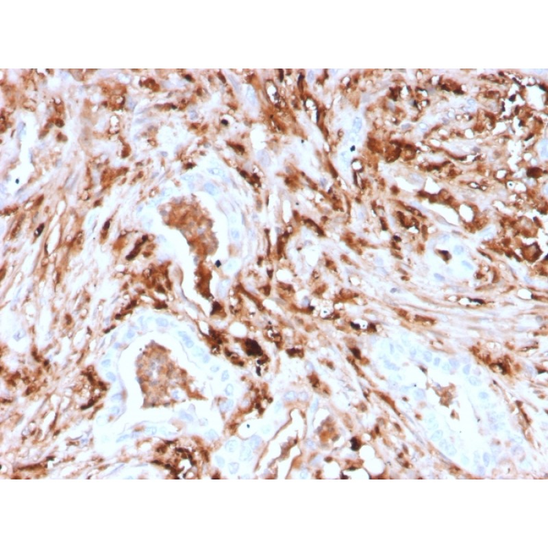 Ferritin, Light Chain (Node-Negative Breast Tumor Prognostic Marker)(rFTL/1388), CF568 conjugate, 0.1mg/mL