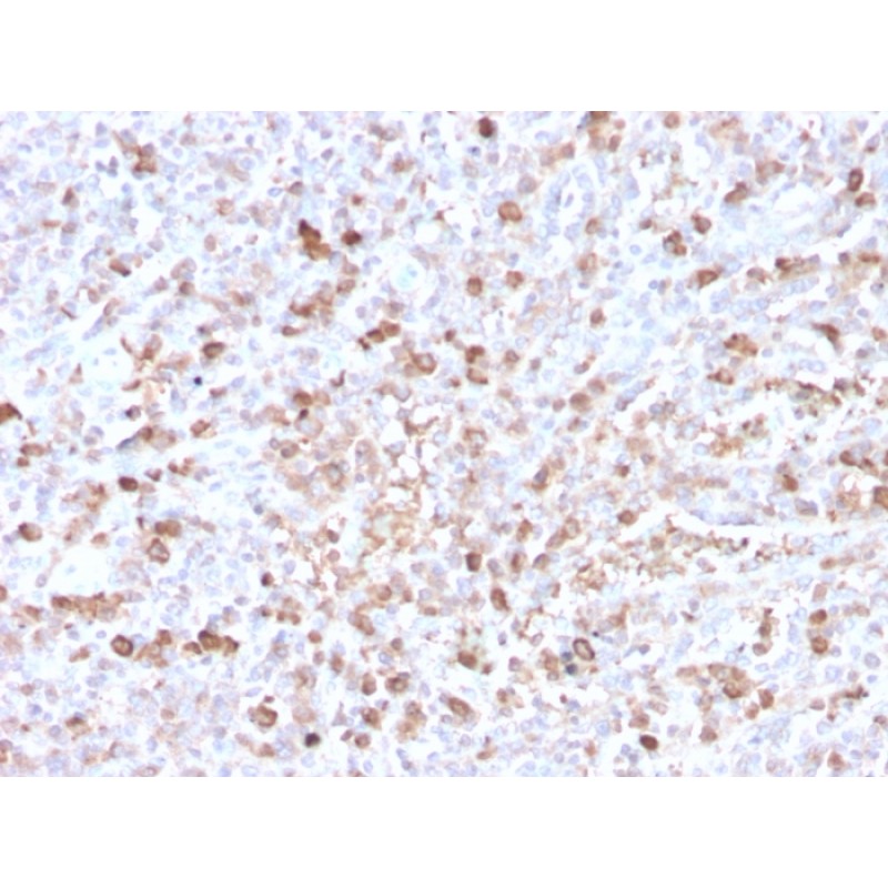 Human Lambda Light Chain (B-Cell Marker)(LLC/3778R), CF568 conjugate, 0.1mg/mL