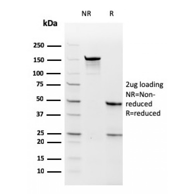 Thymidylate Synthase (5-FU Resistance Marker)(rTYMS/1884), CF568 conjugate, 0.1mg/mL
