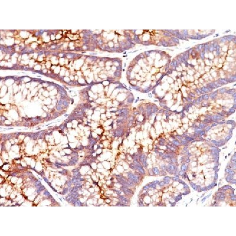 CD66 (CEA)(CEA31), CF740 conjugate, 0.1mg/mL