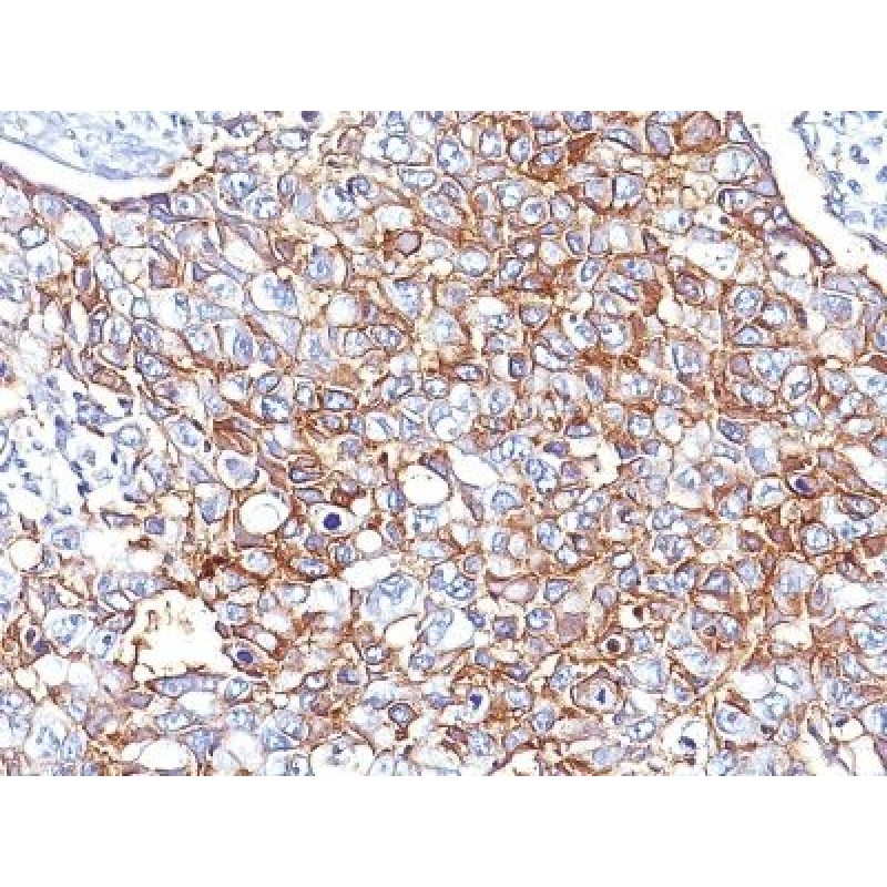 Ep-CAM / CD326(EGP40/826 + EGP40/837 + EGP40/1110 + EGP40/1120), CF740 conjugate, 0.1mg/mL