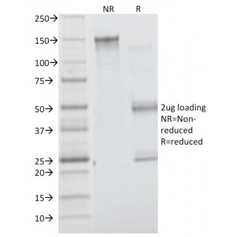 Insulin Receptor Alpha(INSR/1661), CF740 conjugate, 0.1mg/mL
