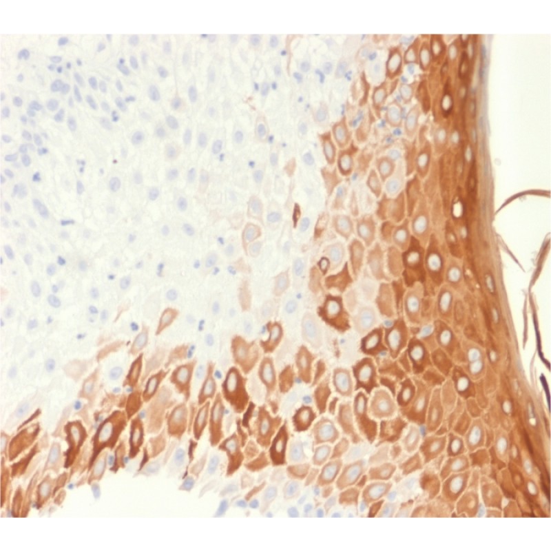 Cytokeratin 10 (Suprabasal Epithelial Marker) (rKRT10/1275), CF740 conjugate, 0.1mg/mL