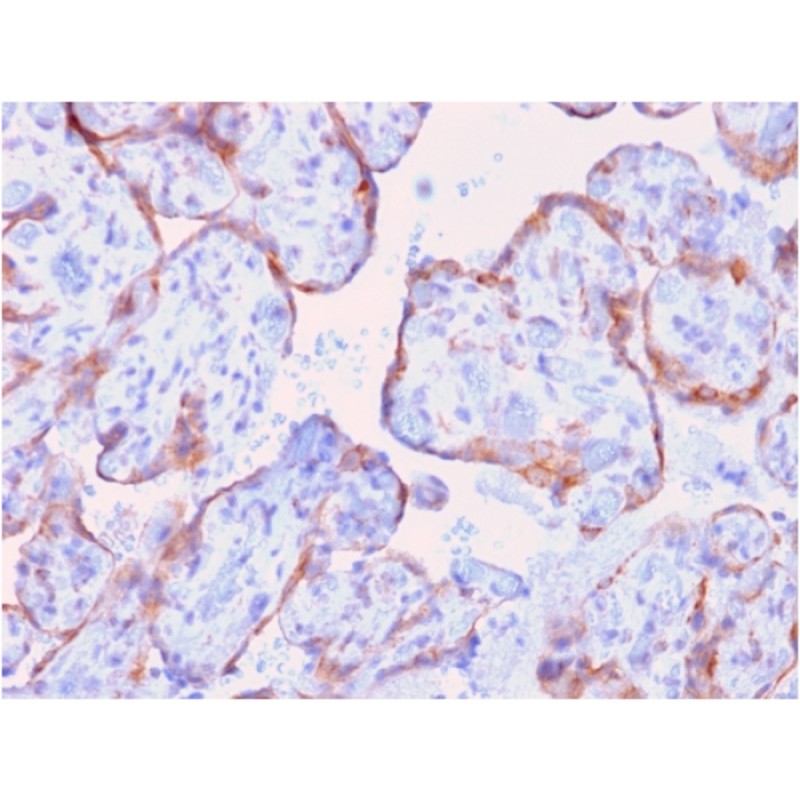 MMP3 (Marker of Metastasis and Rheumatoid Arthritis)(rMMP3/1730), CF740 conjugate, 0.1mg/mL