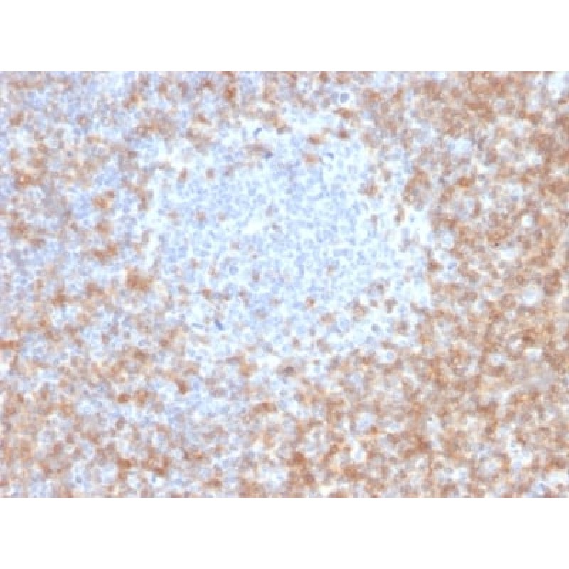 CD5 (Mantle Cell Lymphoma Marker) (CD5/2416), CF740 conjugate, 0.1mg/mL