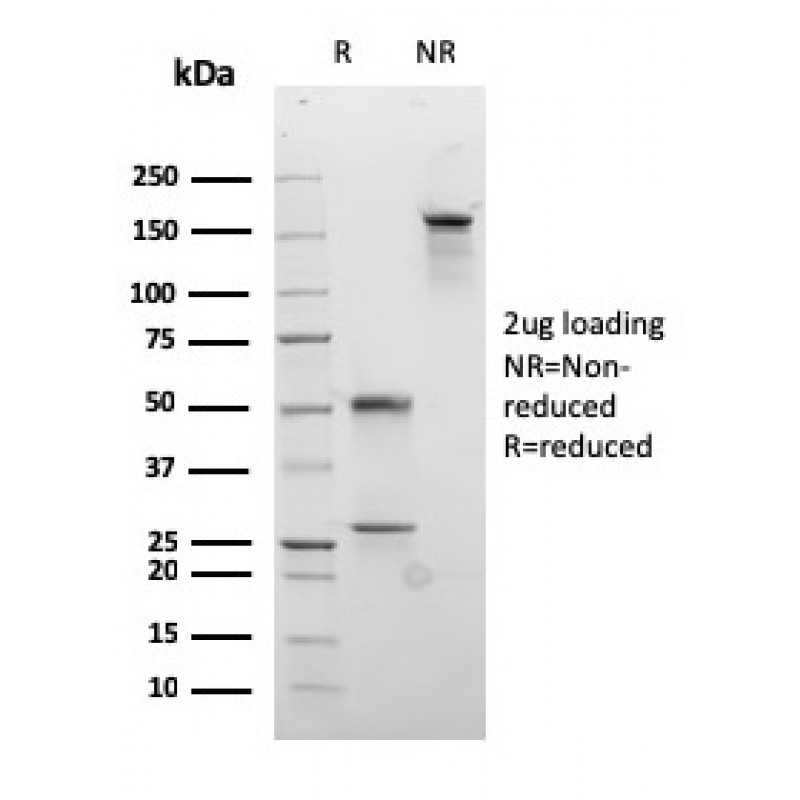 Desmocollin-2/3(rDSC2/3437), CF740 conjugate, 0.1mg/mL