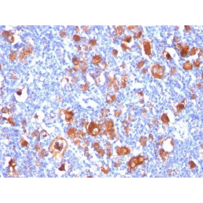 Fascin-1(FSCN1/418), CF488A conjugate, 0.1mg/mL