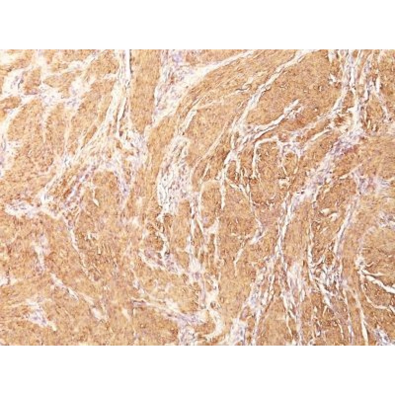 Muscle Specific Actin(HHF35), CF488A conjugate, 0.1mg/mL