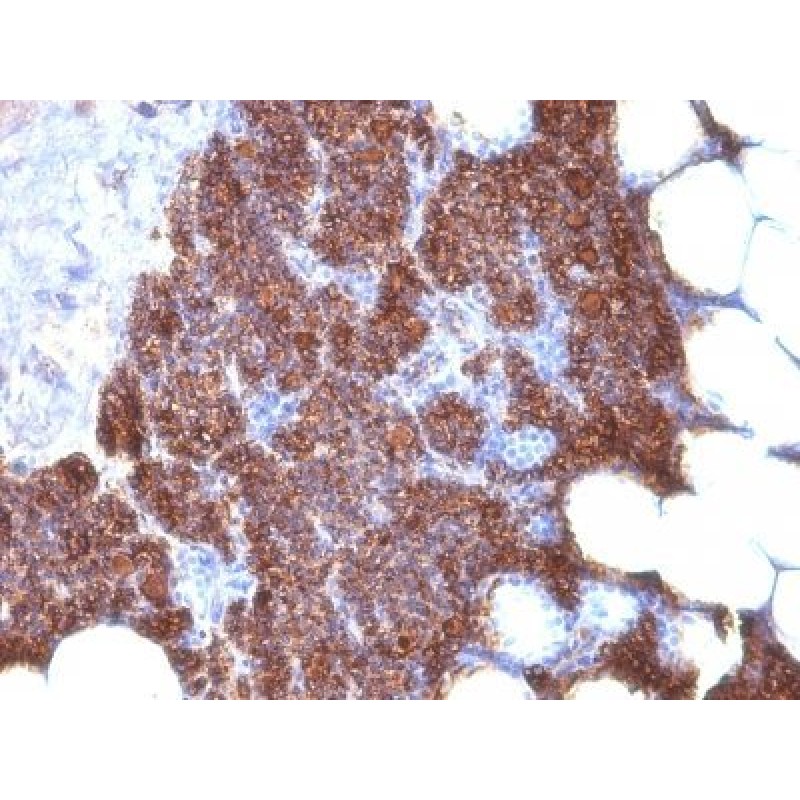 PTH (Parathyroid Hormone) (N & C Terminal) (3H9 + PTH/1175), CF488A conjugate, 0.1mg/mL