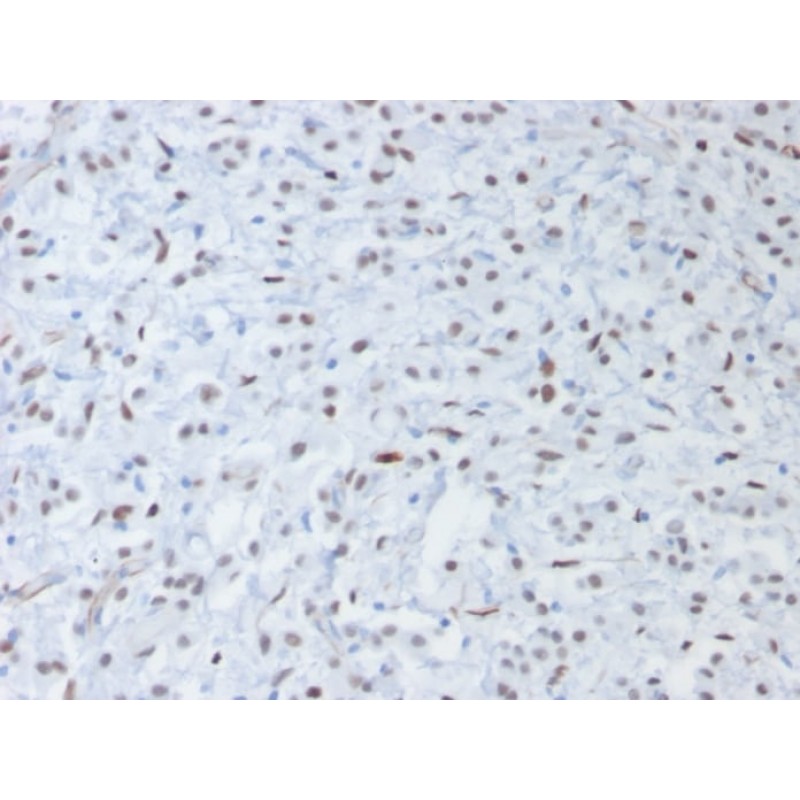 Wilm s Tumor 1 (WT1) (Wilm s Tumor & Mesothelial Marker) (rWT1/857), CF488A conjugate, 0.1mg/mL