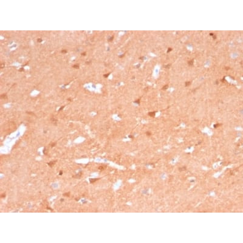 PGP9.5 / UchL1 (pan-Neuronal Marker) (rUCHL1/775), CF488A conjugate, 0.1mg/mL
