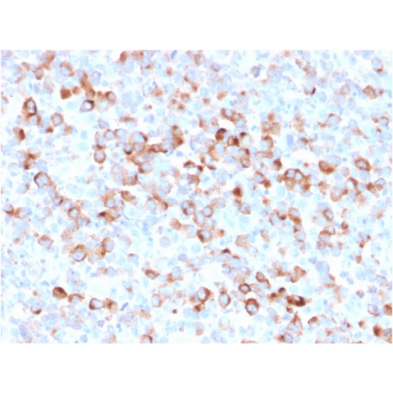 Tyrosinase (Melanoma Marker)(rOCA1/812), CF488A conjugate, 0.1mg/mL